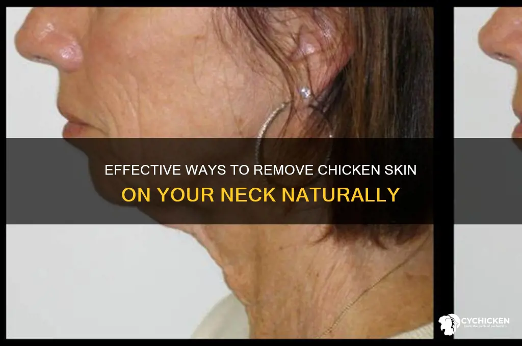 how to remove chicken skin in neck
