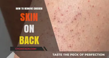 Effective Ways to Remove Chicken Skin on Your Back at Home