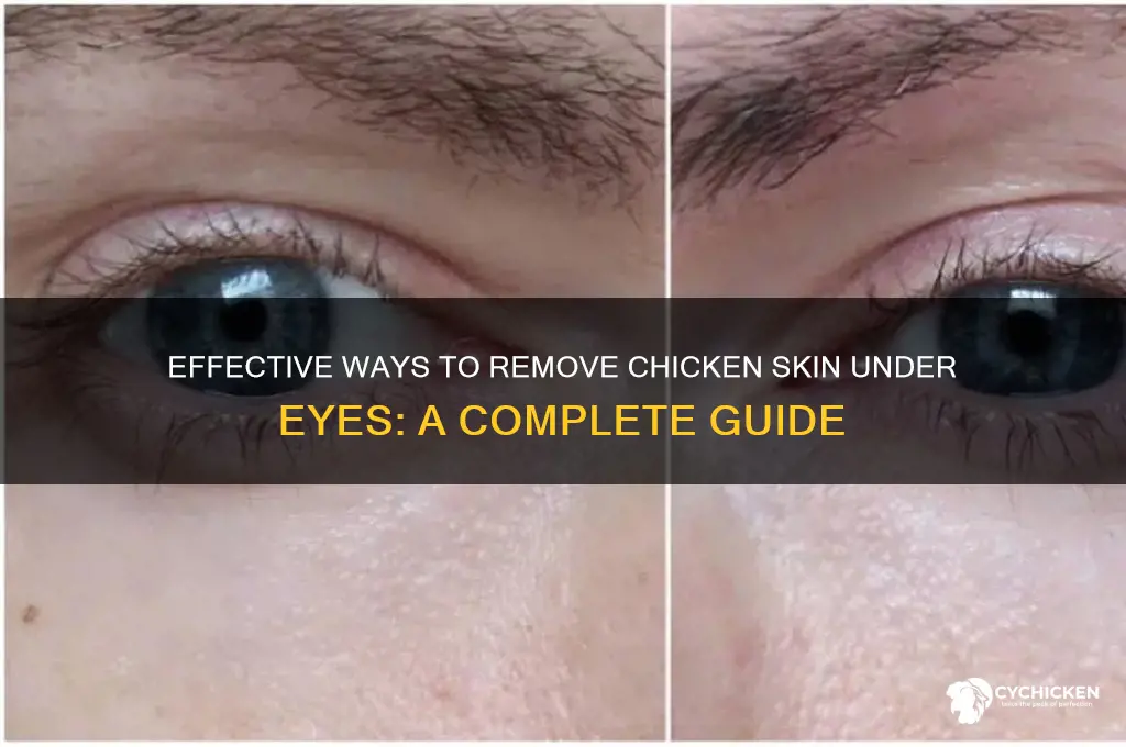 how to remove chicken skin under eyes