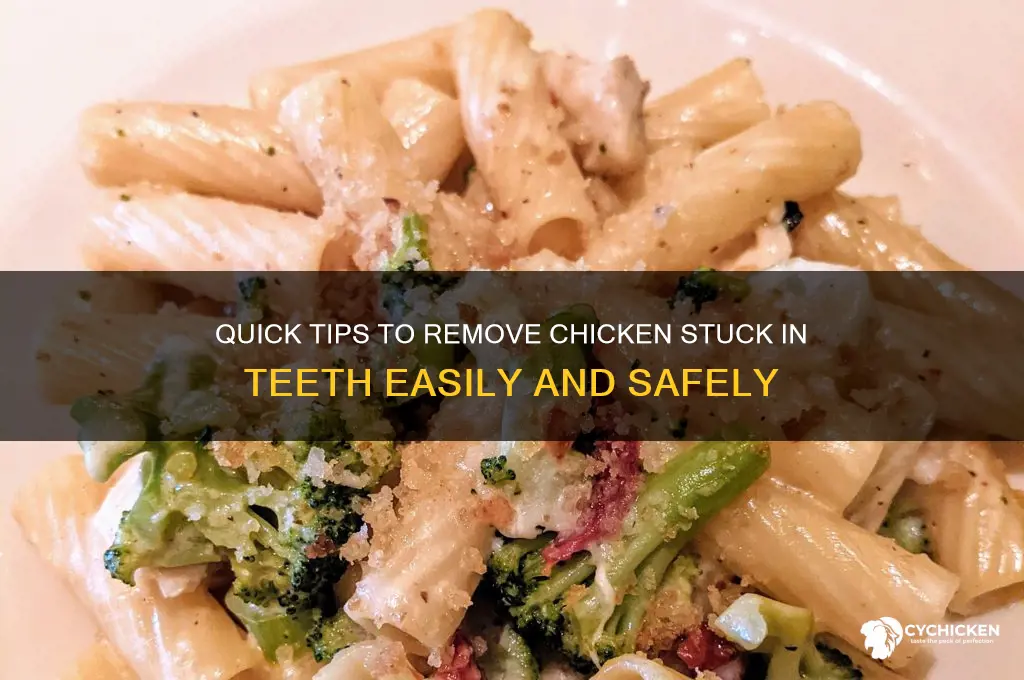 how to remove chicken stuck in teeth