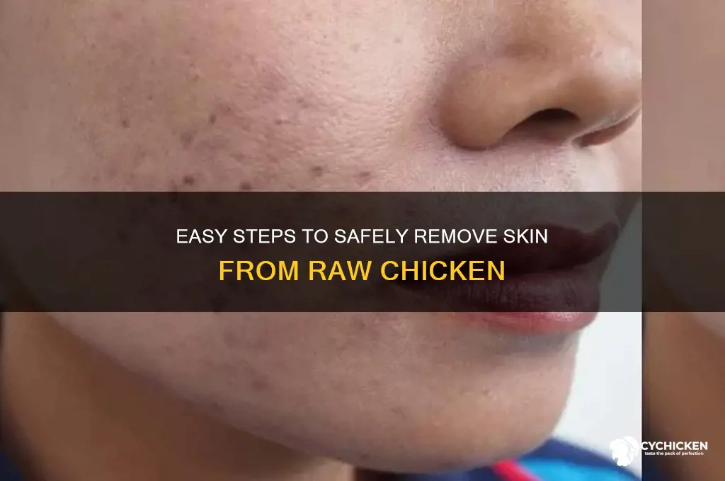 how to remove skin from raw chicken