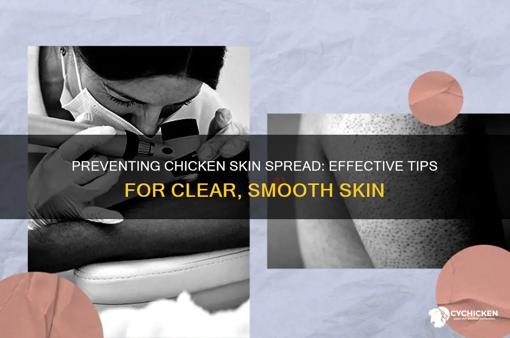 how to stop chicken skin from spreading