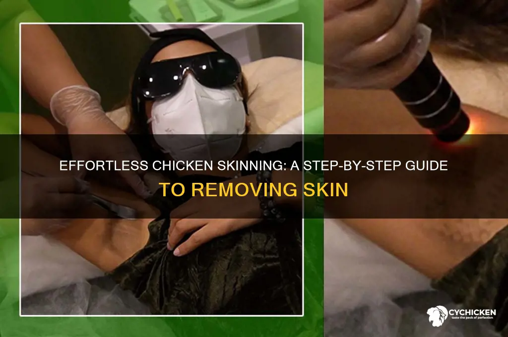 how to take skin off a chicken