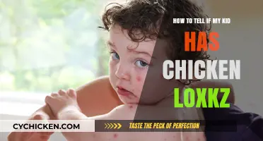 Signs Your Child May Have Chickenpox