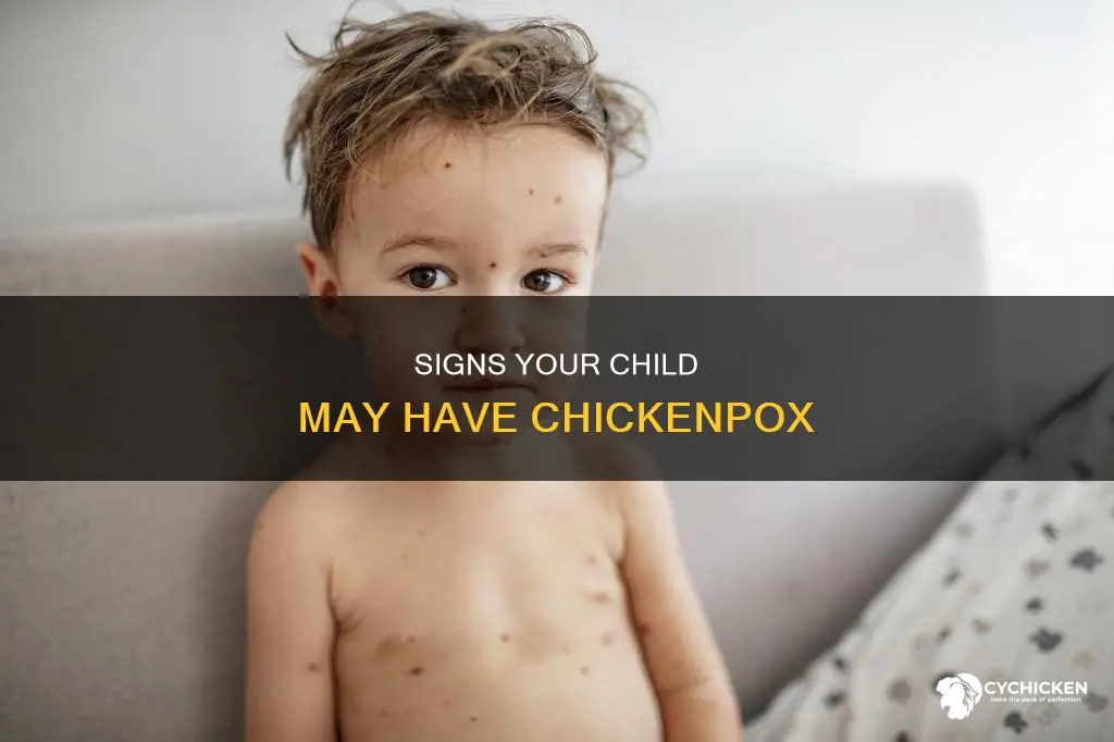 how to tell if my kid has chicken loxkz