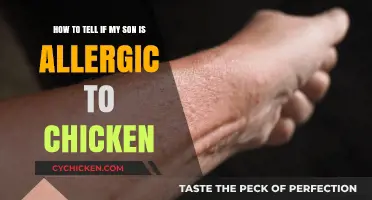 Signs Your Son May Be Allergic to Chicken