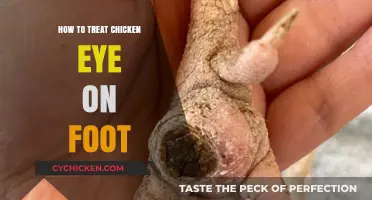 Effective Treatment for Chicken Eye on Foot: A Comprehensive Guide