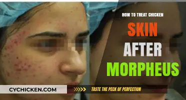 Post-Morpheus8 Chicken Skin Care: Effective Treatment Tips and Strategies