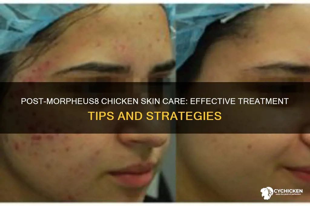 how to treat chicken skin after morpheus8
