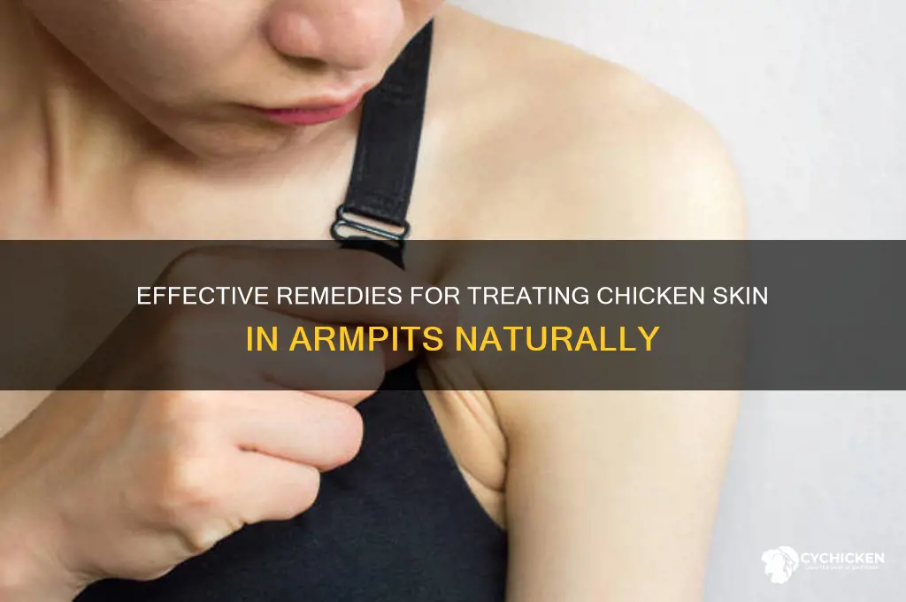 how to treat chicken skin in armpit