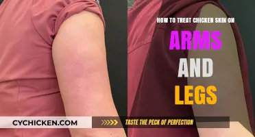 Treating Chicken Skin: Arms and Legs