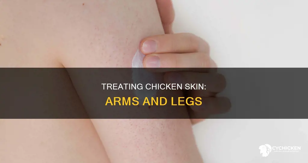 how to treat chicken skin on arms and legs