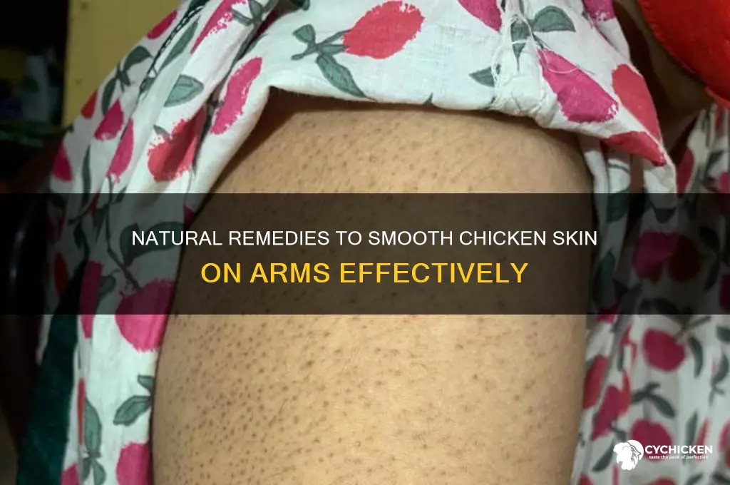 how to treat chicken skin on arms naturally