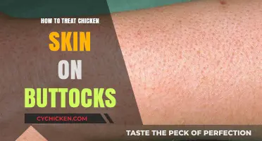 Effective Ways to Treat Chicken Skin on Buttocks Naturally