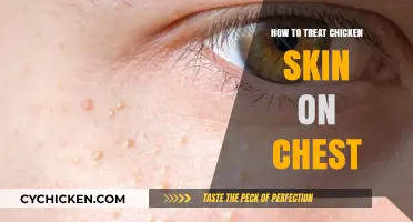 Effective Ways to Treat Chicken Skin on Your Chest