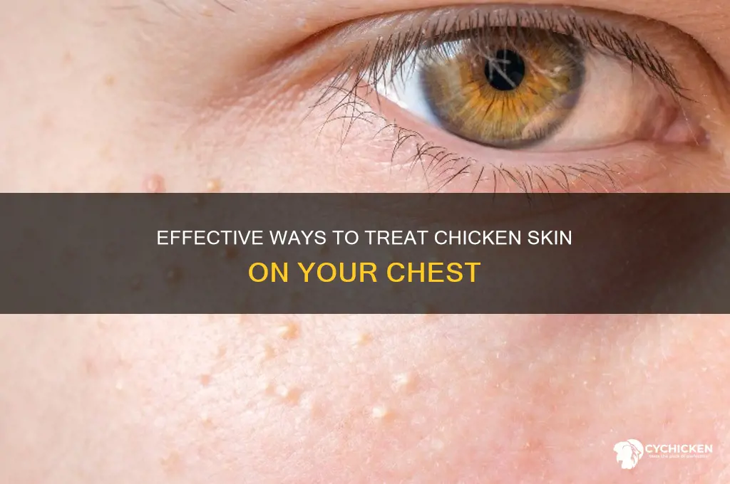 how to treat chicken skin on chest