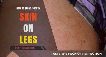 Effective Treatments for Chicken Skin on Legs: Smooth, Clear Skin Solutions