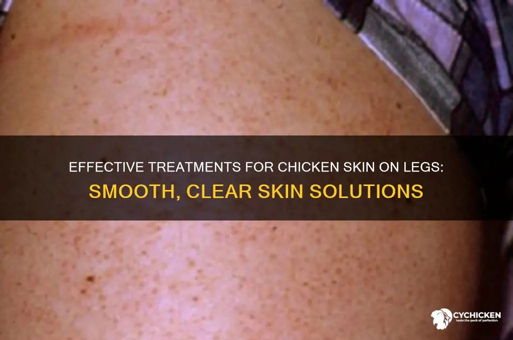 how to treat chicken skin on legs