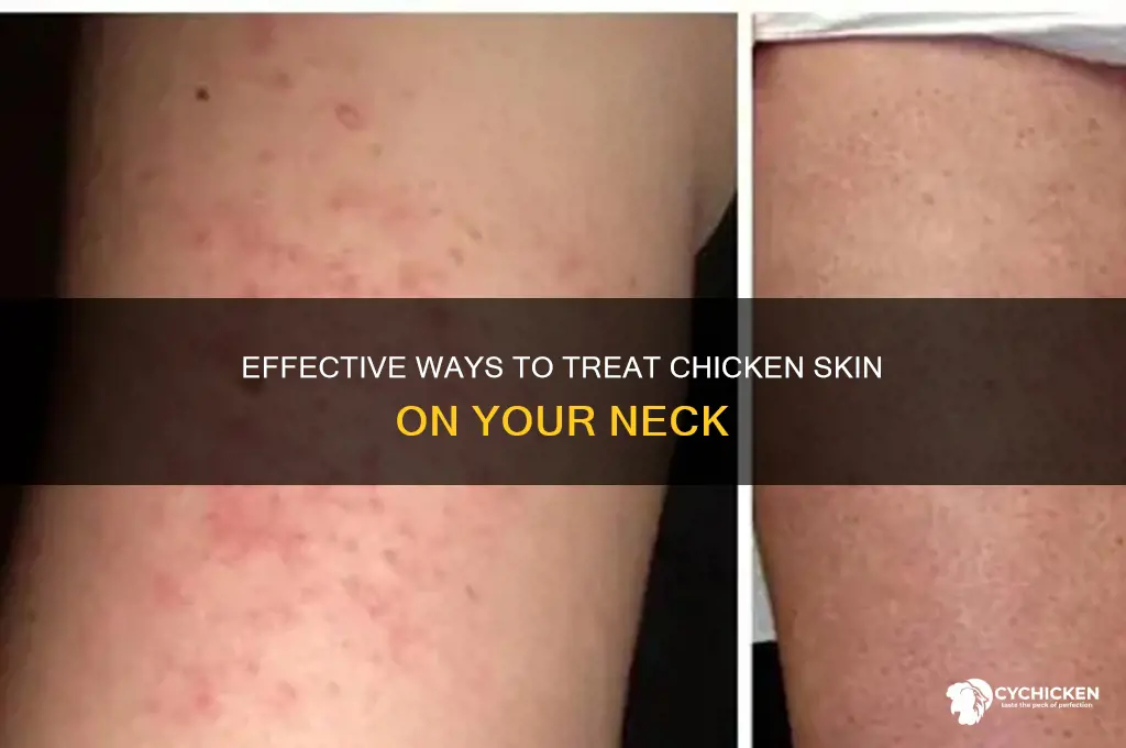 how to treat chicken skin on neck