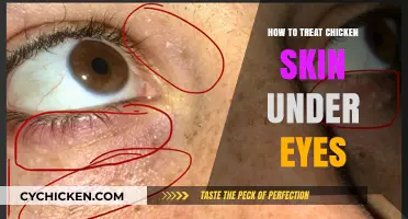 Effective Remedies for Treating Chicken Skin Under Eyes: A Comprehensive Guide