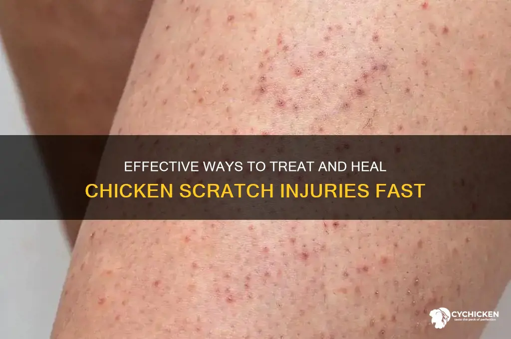 how to treat scratches from a chicken