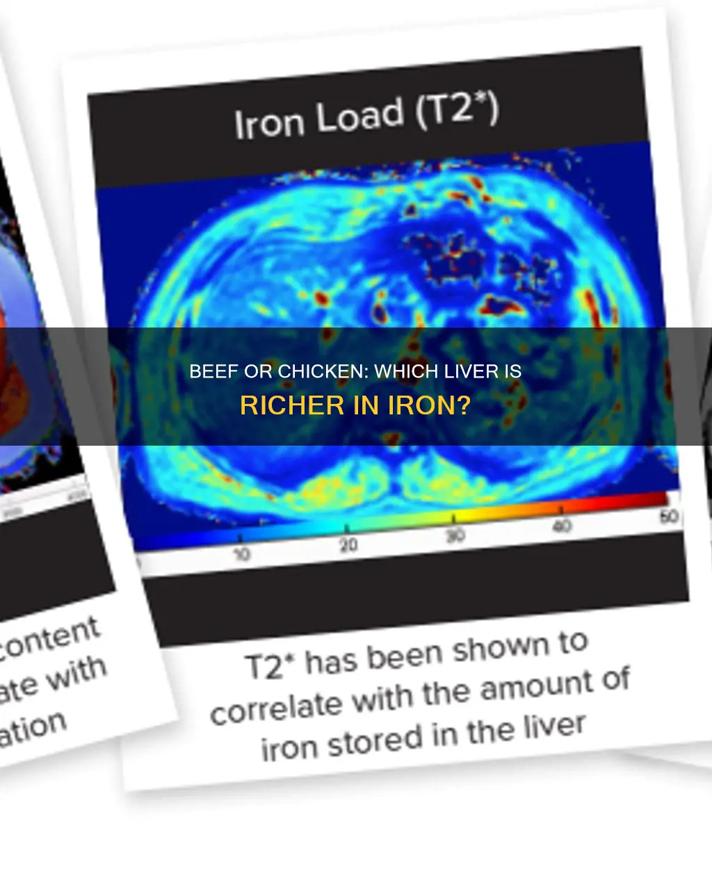 is beef liver or chicken liver higher in iron