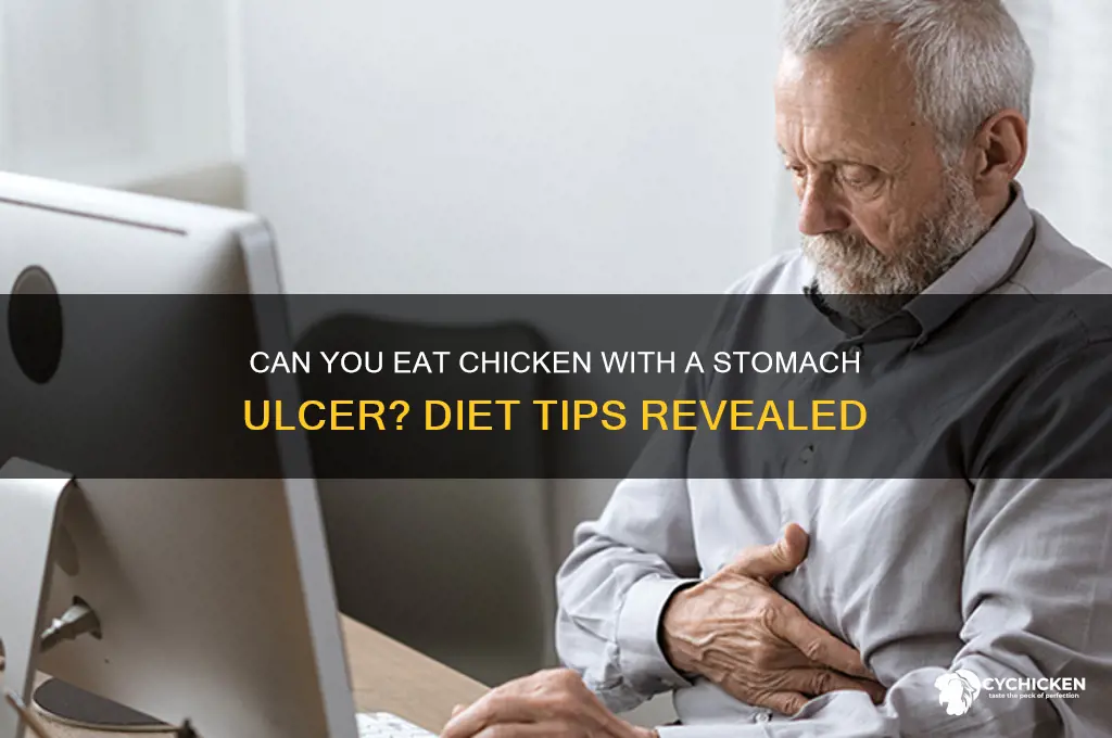 is chicken ok for a stomach ulcer