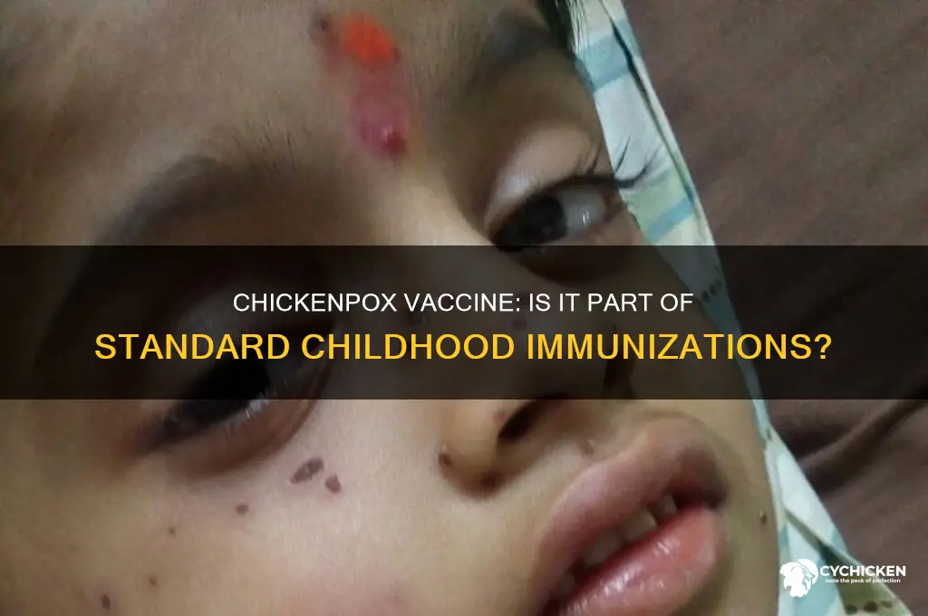 is chicken pix vaccine included in childhood vaccines
