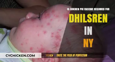 Chicken Pox Vaccine: What NY Children Need