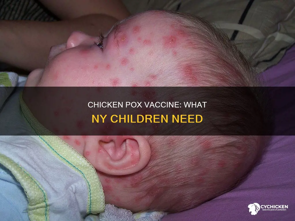 is chicken pix vaccine required for dhilsren in ny