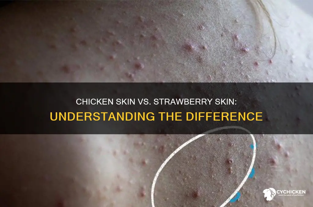 is chicken skin and strawberry skin the same