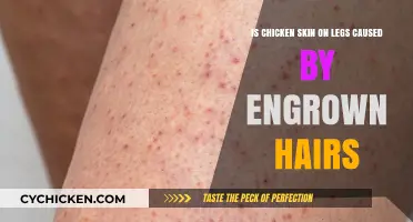 Chicken Skin Legs: Ingrown Hairs or Something Else?