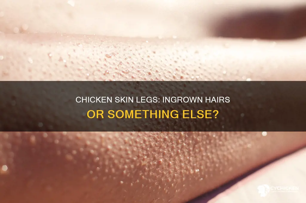 is chicken skin on legs caused by engrown hairs