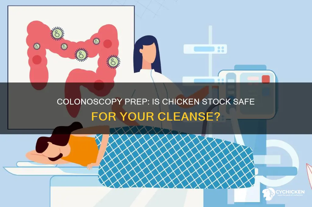 is chicken stock ok for colonoscopy prep