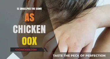 Smallpox vs. Chickenpox: Understanding the Key Differences and Similarities