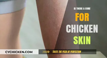 Is There a Cure for Chicken Skin? Effective Treatments Explained