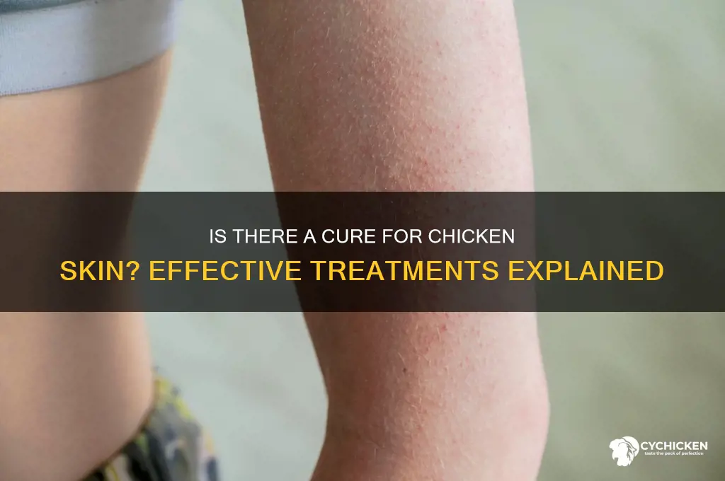 is there a cure for chicken skin