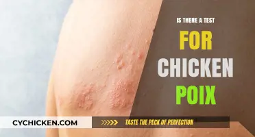 Can You Test for Chickenpox? Diagnosis Methods Explained