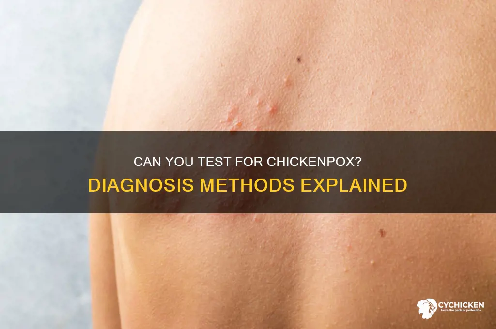 is there a test for chicken poix