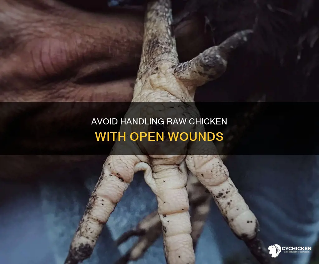 should you handle raw chicken with an open wound