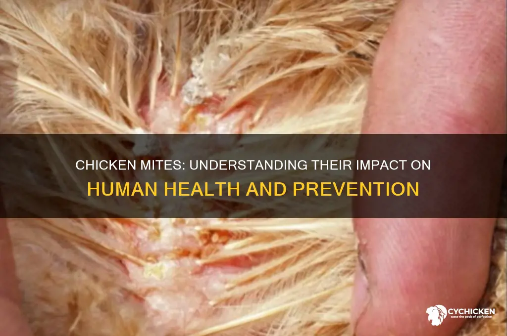 what affects do chicken mites have on humans