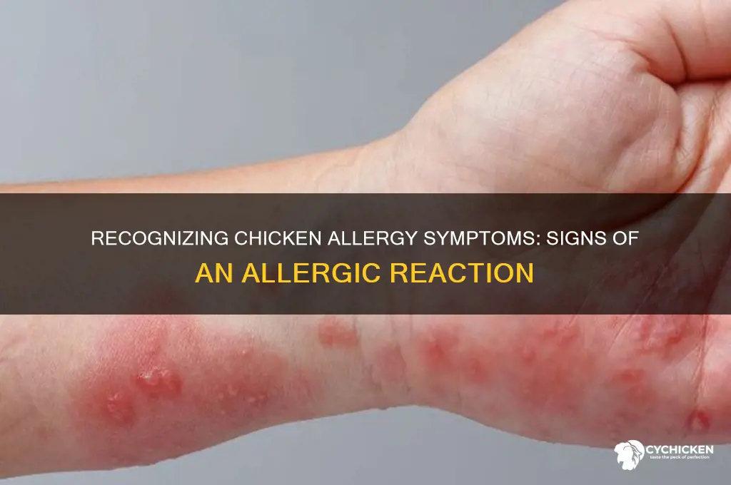 what are symptoms of allergic reactions to chicken