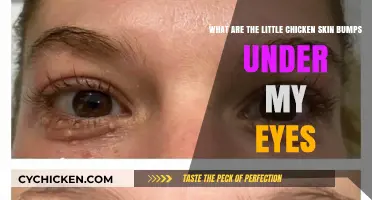 Understanding Bumps Under Eyes: Chicken Skin Bumps Explained