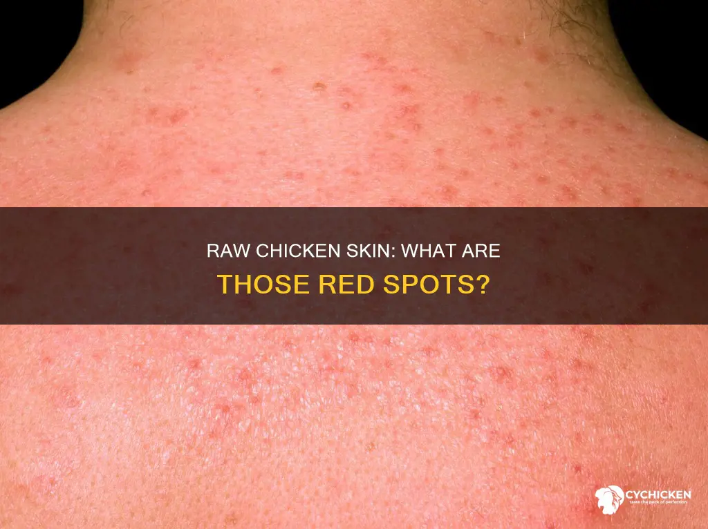 what are the red spots on raw chicken skin