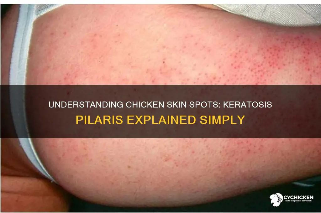 what are the spots on chicken skin called