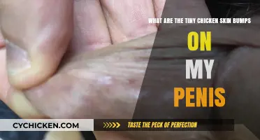 Pearly Penile Papules: What Are These Bumps?