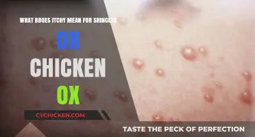 Itchy Shingles and Chicken Pox: What's the Deal?