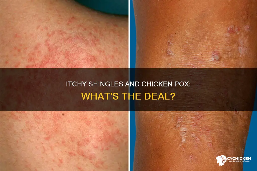 what bdoes itchy mean for shingles or chicken ox