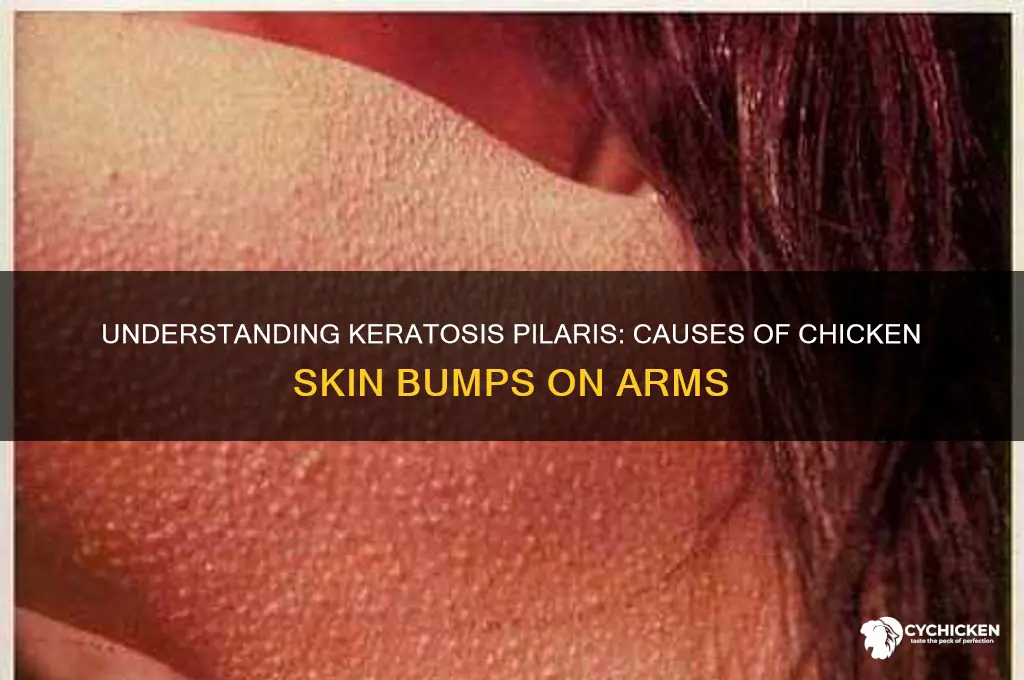 what causes chicken skin bumps on arms