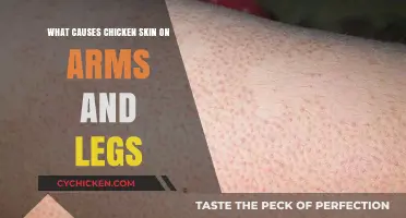 Understanding Keratosis Pilaris: Causes of Chicken Skin on Arms and Legs